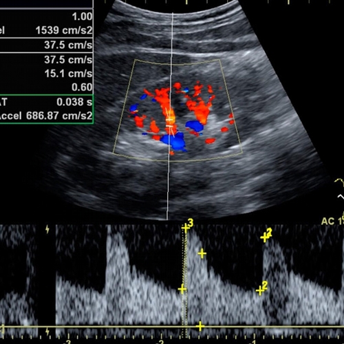 Ecocolor_doppler_cardiaco_01