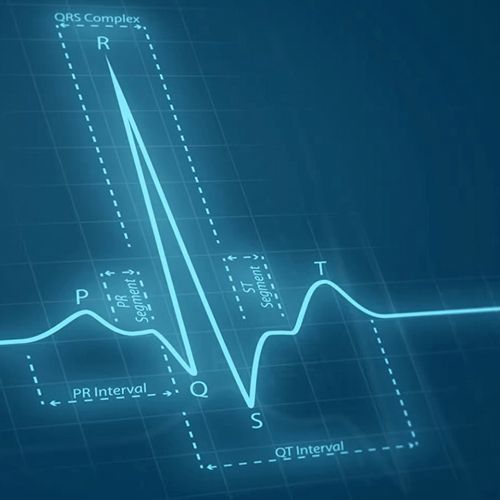 Elettrocardiogramma_01